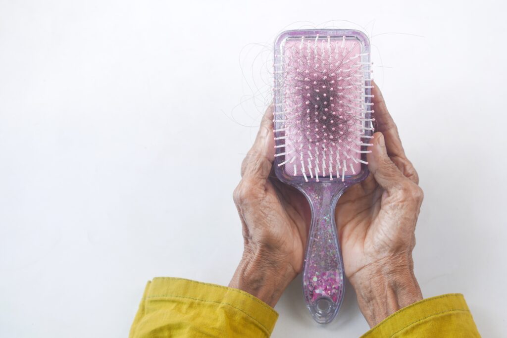 Image of a hair brush with hair in it - This is for a blog post about hair transplant surgery.