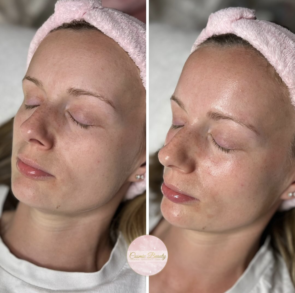 Pre and post youthful goddess facial - 1st session