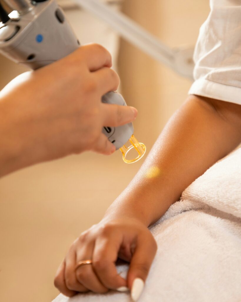 Laser hair removal.