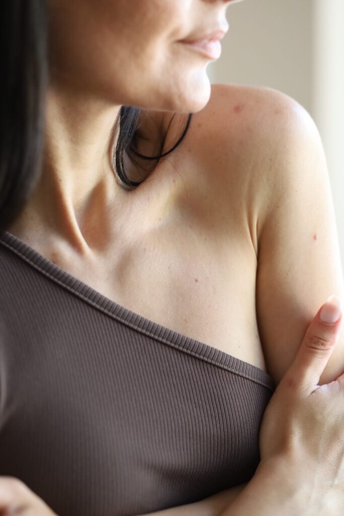 Lady showing natural skin. This is to go with an article about wart removal.