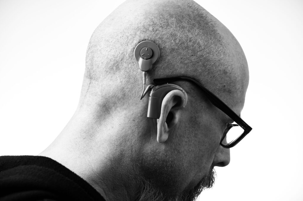 Black and white image of a man waring a cochlear implant hearing device.